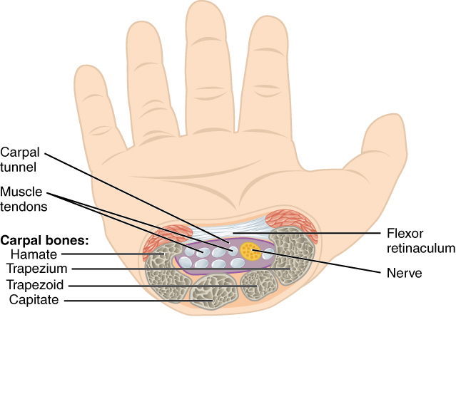 Carpal Tunnel Release